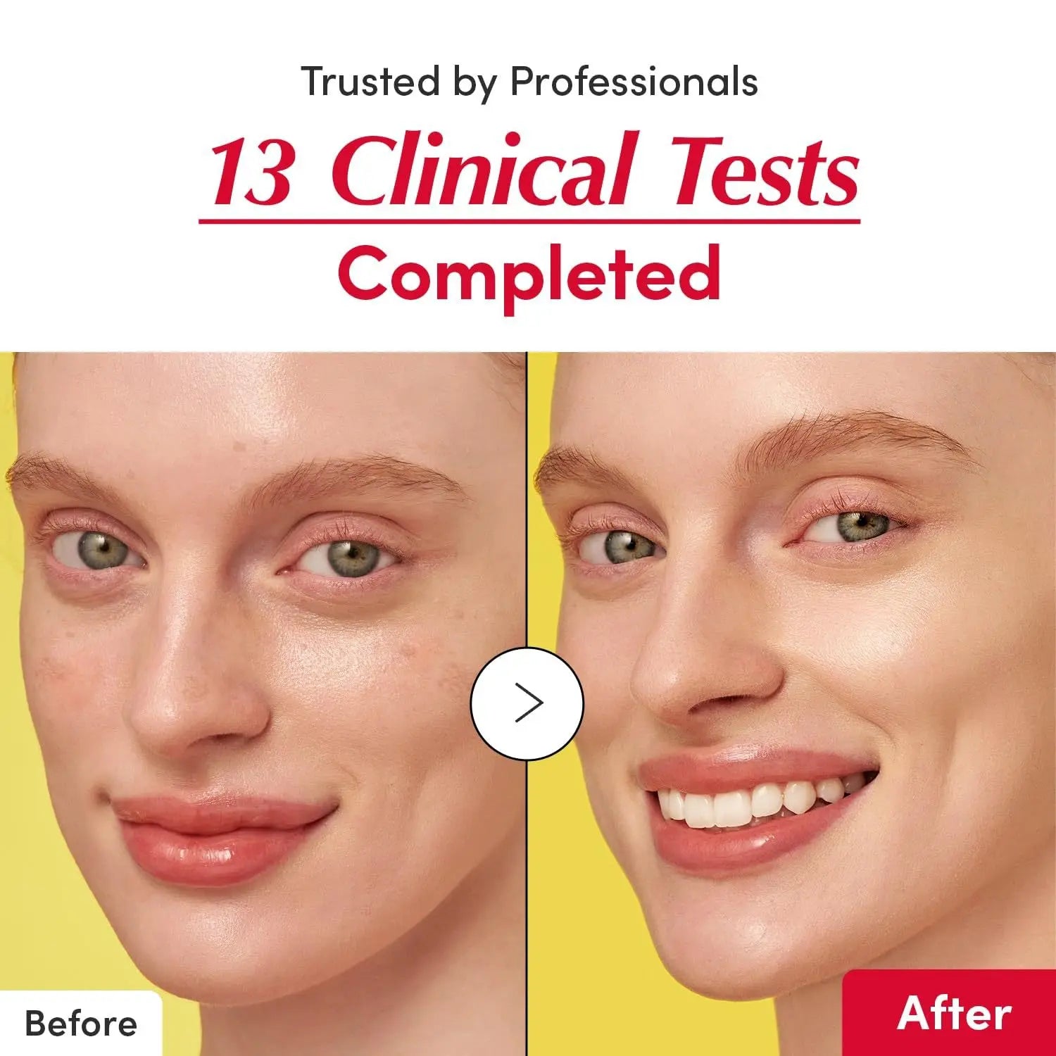 Vitamin Whitening Serum, Niacinamide Vitamin C Serum, Bakuchiol Plumping Serum, Shrink Pores, Reduce Wrinkles, and Lift Skin